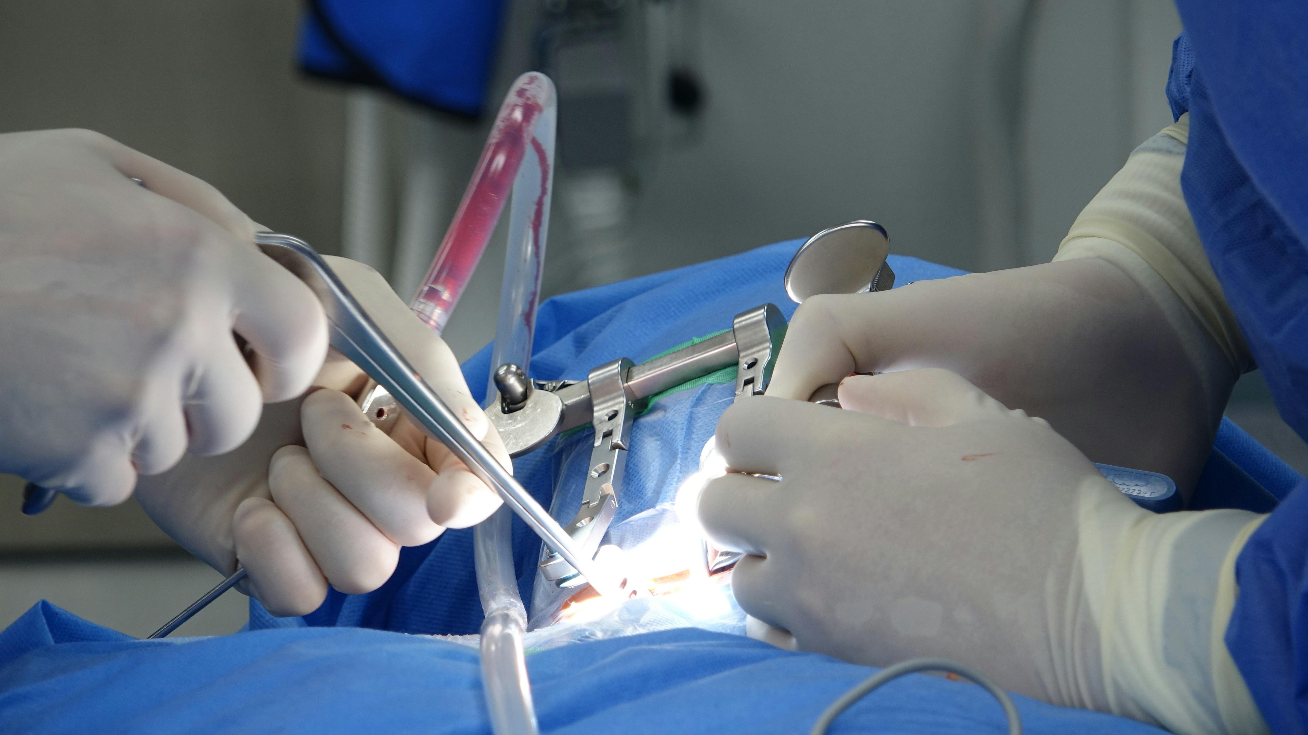 Practical Ways to Optimize Your Diet After Colonoscopy in 2025