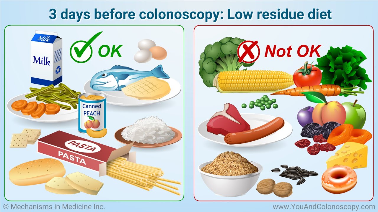 Essential Guide to Colonoscopy Diet: Important Tips for 2025