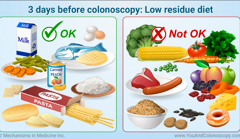 Essential Guide to Low Fiber Diet Before Colonoscopy: Discover Smart Tips for 2025